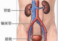 膀胱癌治疗,膀胱癌治疗策略与综合治疗方案